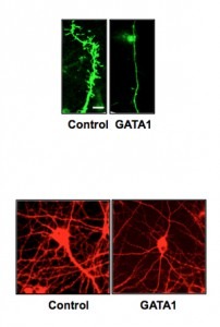 Depressão - a expressão de um único gene (GATA1) diminui drasticamente conexões sinápticas entre as células do cérebro (Fonte: Yale University)