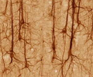 Envelhecimento - Neurônios do Cortex Cerebral (Fonte: Wikipedia)