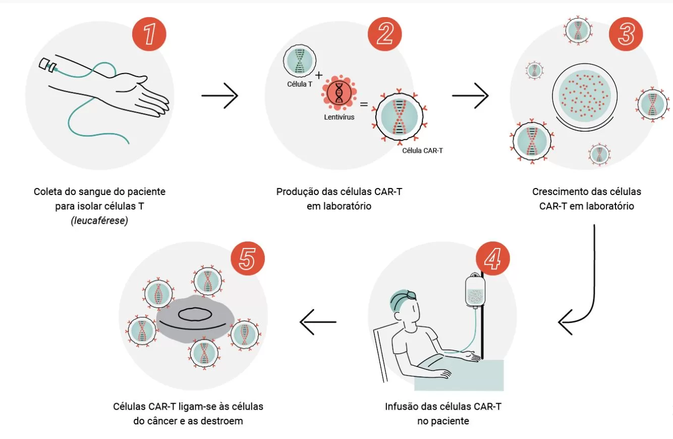 Terapia com Células CAR-T